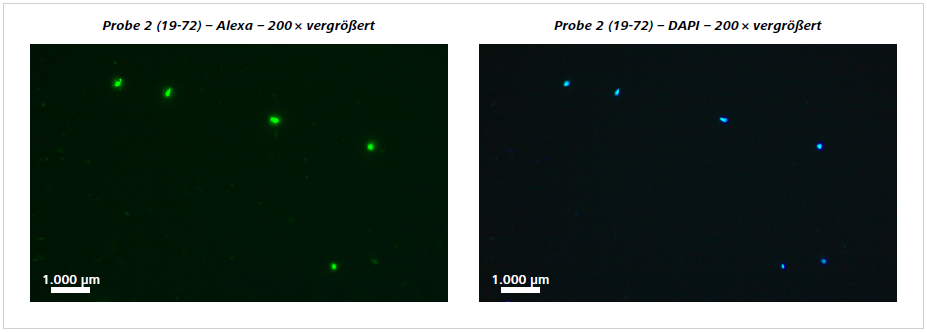 Abbildung 3 Einzelproben: Antikörper basierte Spermienfärbung mit HY-Liter (grüne Fluoreszenz) und parallele Anfärbung der Zellkerne mit DAPI